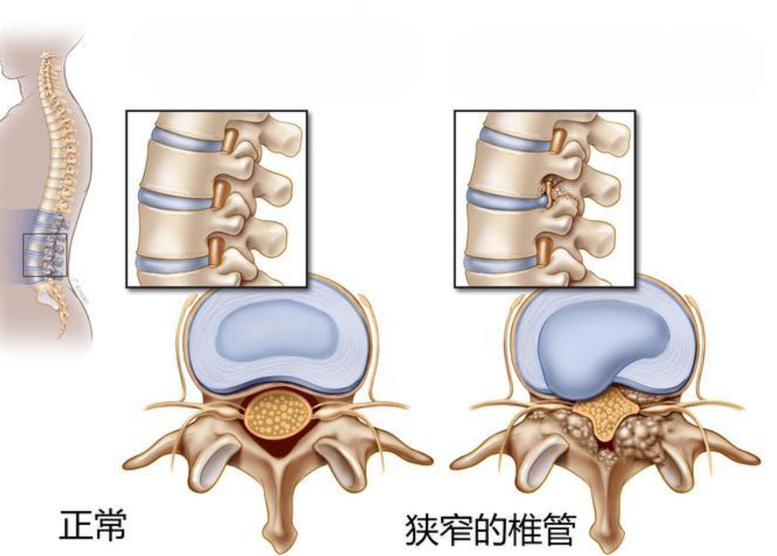 邵陽創(chuàng)傷骨科,邵陽風濕病區(qū),邵陽骨質增生,邵陽關節(jié)病區(qū),邵陽頸椎病區(qū)