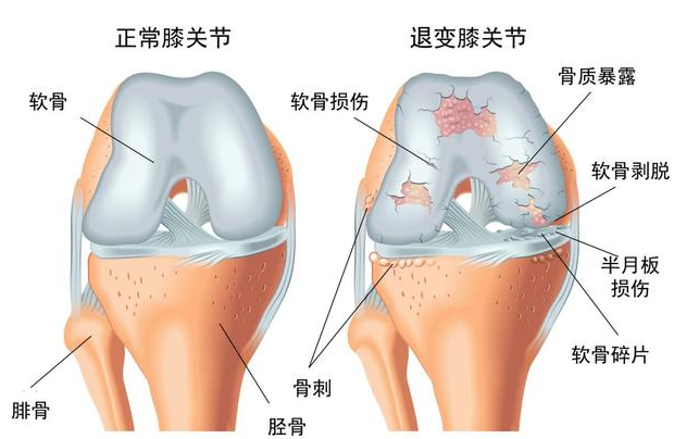 邵陽(yáng)創(chuàng)傷骨科,邵陽(yáng)風(fēng)濕病區(qū),邵陽(yáng)骨質(zhì)增生,邵陽(yáng)關(guān)節(jié)病區(qū),邵陽(yáng)頸椎病區(qū)