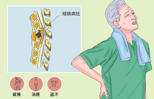 邵陽創(chuàng)傷骨科,邵陽風(fēng)濕病區(qū),邵陽骨質(zhì)增生,邵陽關(guān)節(jié)病區(qū),邵陽頸椎病區(qū)